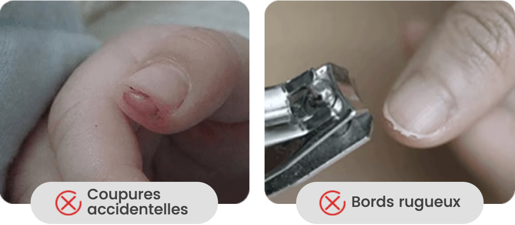 NailEase™ – Des ongles nets sans effort