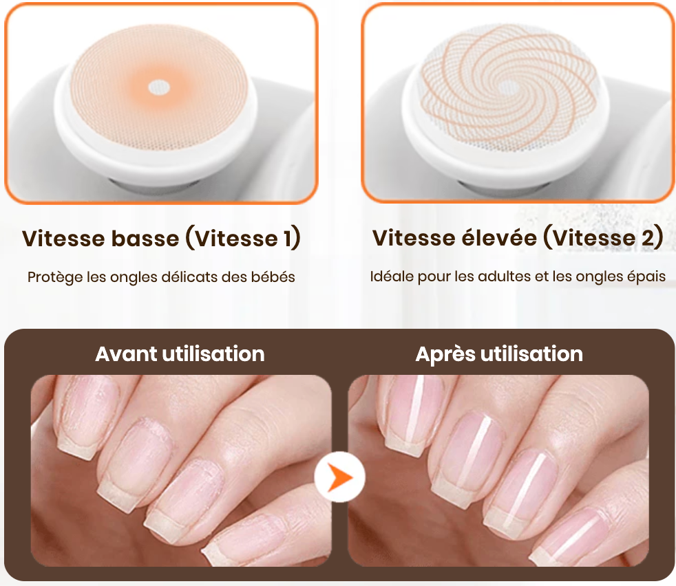 NailEase™ – Des ongles nets sans effort