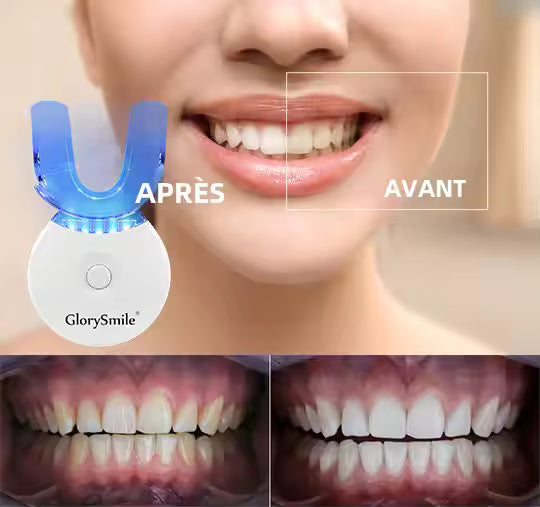 Blanchiment dentaire